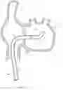Fig. 05 - Multi-directional steerable catheter