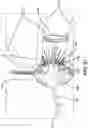 Fig. 20 - One-motion handle for steerable catheter