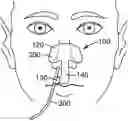 Fig. 01 - Tube securement device