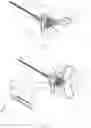 Fig. 04 - Venous Catheter Device Capable of Being Sealed