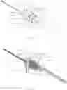 Fig. 05 - Venous Catheter Device Capable of Being Sealed