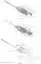 Fig. 17 - Venous Catheter Device Capable of Being Sealed