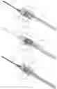 Fig. 18 - Venous Catheter Device Capable of Being Sealed
