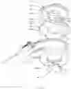 Fig. 26 - Venous Catheter Device Capable of Being Sealed