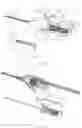 Fig. 32 - Venous Catheter Device Capable of Being Sealed