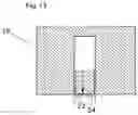 Fig. 09 - IMPLANTABLE DRAINAGE DEVICE