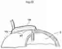 Fig. 18 - IMPLANTABLE DRAINAGE DEVICE