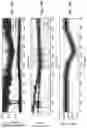 Fig. 23 - Heart pump with impeller rotational speed control