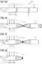 Fig. 05 - Blood pump with flow cannula