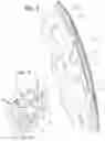 Fig. 04 - UNIVERSAL POWER SUPPLY FOR A FUNCTIONAL CRANIAL IMPLANT