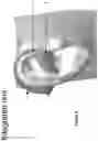 Fig. 03 - PERIPHERAL NERVE STIMULATION DEVICE FOR AFFECTING PARASYMPATHETIC AND SYMPATHETIC ACTIVITY TO ACHIEVE THERAPEUTIC EFFECTS