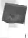 Fig. 06 - PERIPHERAL NERVE STIMULATION DEVICE FOR AFFECTING PARASYMPATHETIC AND SYMPATHETIC ACTIVITY TO ACHIEVE THERAPEUTIC EFFECTS