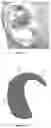 Fig. 14 - PERIPHERAL NERVE STIMULATION DEVICE FOR AFFECTING PARASYMPATHETIC AND SYMPATHETIC ACTIVITY TO ACHIEVE THERAPEUTIC EFFECTS