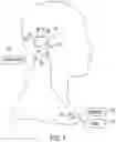 Fig. 02 - Implantable cochlear system with inner ear sensor