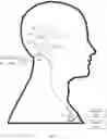 Fig. 02 - Combination hearing aid and cochlear implant system