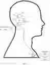 Fig. 05 - Combination hearing aid and cochlear implant system