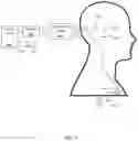 Fig. 10 - Combination hearing aid and cochlear implant system