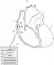 Fig. 01 - DEVICE AND METHOD FOR ATRIAL TACHYARRHYTHMIA DETECTION