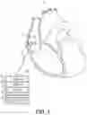 Fig. 02 - DEVICE AND METHOD FOR ATRIAL TACHYARRHYTHMIA DETECTION