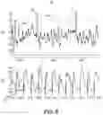 Fig. 12 - DEVICE AND METHOD FOR ATRIAL TACHYARRHYTHMIA DETECTION