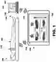 Fig. 02 - Evaluation and adjustment of left bundle branch (LBB) pacing therapy