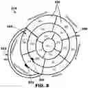 Fig. 09 - Evaluation and adjustment of left bundle branch (LBB) pacing therapy