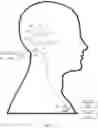 Fig. 02 - Cochlear implant stimulation calibration