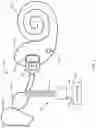 Fig. 04 - Cochlear implant stimulation calibration