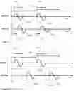 Fig. 41 - Methods and devices for aesthetic treatment of biological structures by radiofrequency and magnetic energy