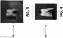 Fig. 03 - TEETH CLEANING AND REMINERALIZING TOOTHPASTES