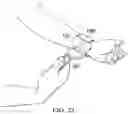 Fig. 21 - PORTABLE RESISTANCE WORKOUT APPARATUSES AND SYSTEMS