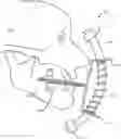 Fig. 01 - Dynamic mouth opening device