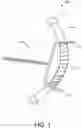 Fig. 02 - Dynamic mouth opening device
