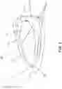 Fig. 03 - GOLF CLUB HEAD WITH INSERT