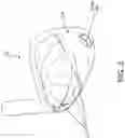 Fig. 04 - GOLF CLUB HEAD WITH INSERT