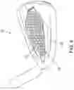 Fig. 07 - GOLF CLUB HEAD WITH INSERT