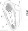 Fig. 18 - GOLF CLUB HEAD WITH INSERT