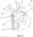 Fig. 24 - GOLF CLUB HEAD WITH INSERT