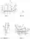 Fig. 02 - Golf clubs having weighting system with movable weights