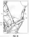 Fig. 14 - Removable snap-in strap system