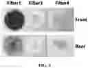 Fig. 04 - MULTI-LAYERED FILTER FOR SEPARATING BLOOD COMPONENTS AND DISEASE DIAGNOSIS KIT USING THE SAME