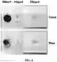 Fig. 05 - MULTI-LAYERED FILTER FOR SEPARATING BLOOD COMPONENTS AND DISEASE DIAGNOSIS KIT USING THE SAME