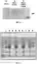 Fig. 06 - MULTI-LAYERED FILTER FOR SEPARATING BLOOD COMPONENTS AND DISEASE DIAGNOSIS KIT USING THE SAME
