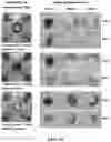 Fig. 09 - MULTI-LAYERED FILTER FOR SEPARATING BLOOD COMPONENTS AND DISEASE DIAGNOSIS KIT USING THE SAME