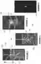 Fig. 04 - Microfluidic devices and systems, and methods for operating microfluidic devices and systems