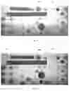 Fig. 09 - Microfluidic system based on active control of flow resistance in microfluidic channels and methods of use thereof