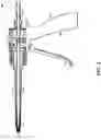 Fig. 03 - Dispensing apparatus and method