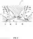 Fig. 03 - COLD SPRAY DEVICE