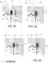 Fig. 09 - Double seam modification tooling apparatus and double seam modification process