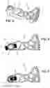 Fig. 03 - Method for assembling a motor vehicle heating, ventilation and/or air conditioning device